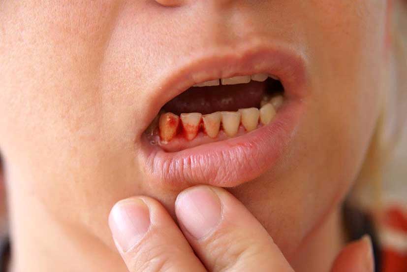 injured-tooth-dental-emergency