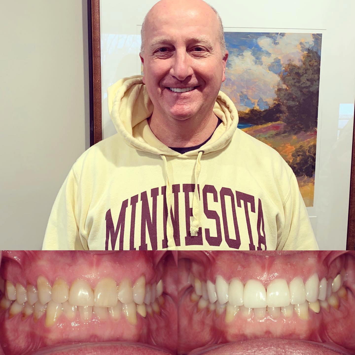 family-dental-patients-Chalet Dental Care-st-paul